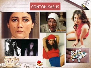 CONTOH KASUS
 
