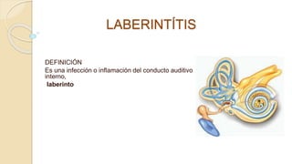 LABERINTÍTIS
DEFINICIÓN
Es una infección o inflamación del conducto auditivo
interno,
laberinto
 