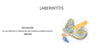 LABERINTÍTIS
DEFINICIÓN
Es una infección o inflamación del conducto auditivo interno,
laberinto
 