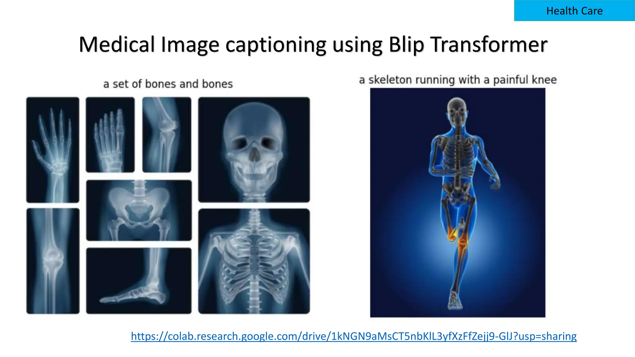 Medical Image captioning using Blip Transformer
Health Care
https://colab.research.google.com/drive/1kNGN9aMsCT5nbKlL3yfXzFfZejj9-GlJ?usp=sharing
 