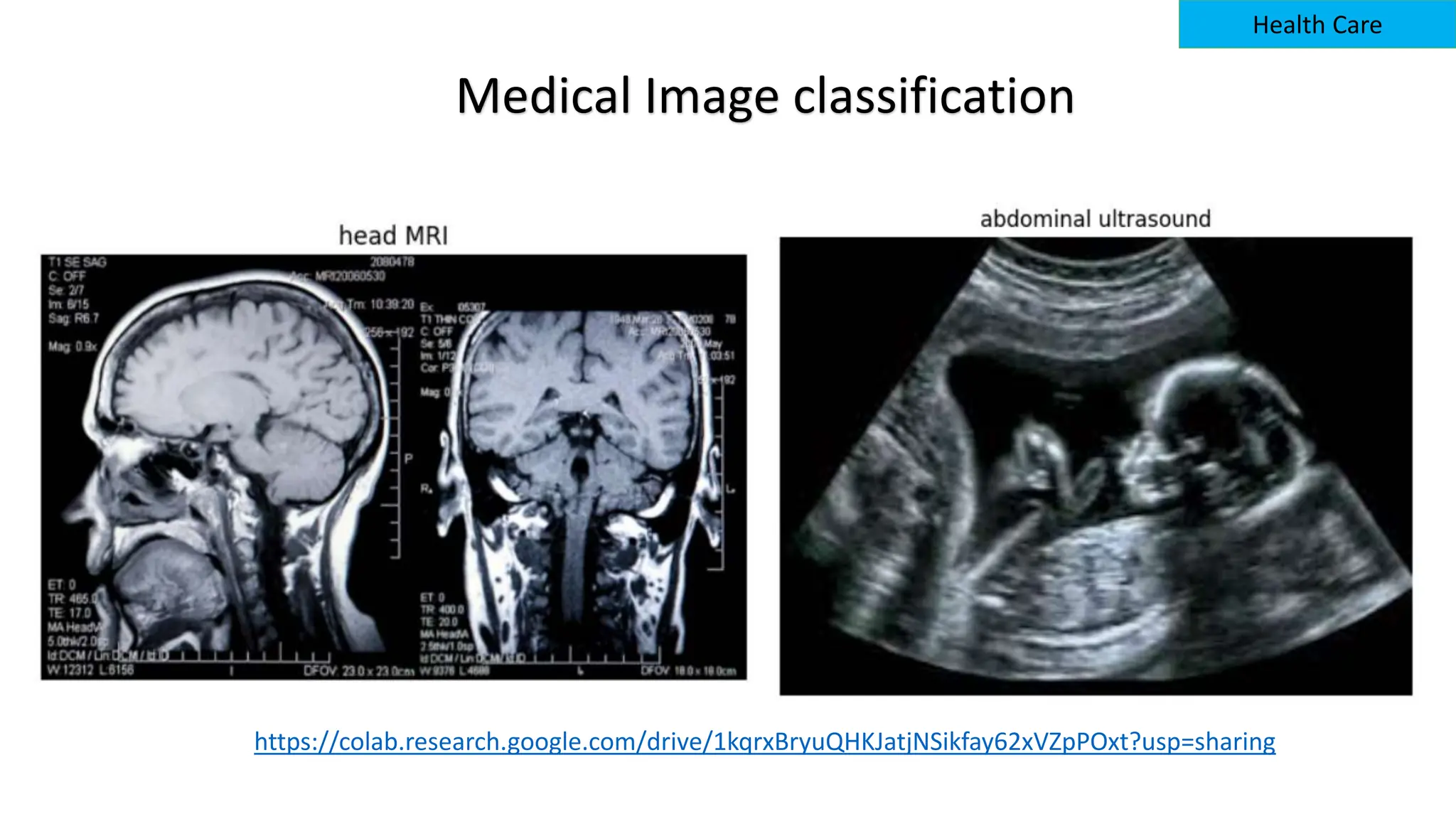Medical Image classification
Health Care
https://colab.research.google.com/drive/1kqrxBryuQHKJatjNSikfay62xVZpPOxt?usp=sharing
 