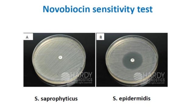 Identification Of Gram Positive Cocci - 638x359 - jpeg S Saprophyticus Novobiocin