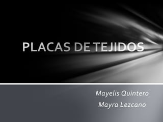 Mayelis Quintero
Mayra Lezcano
 