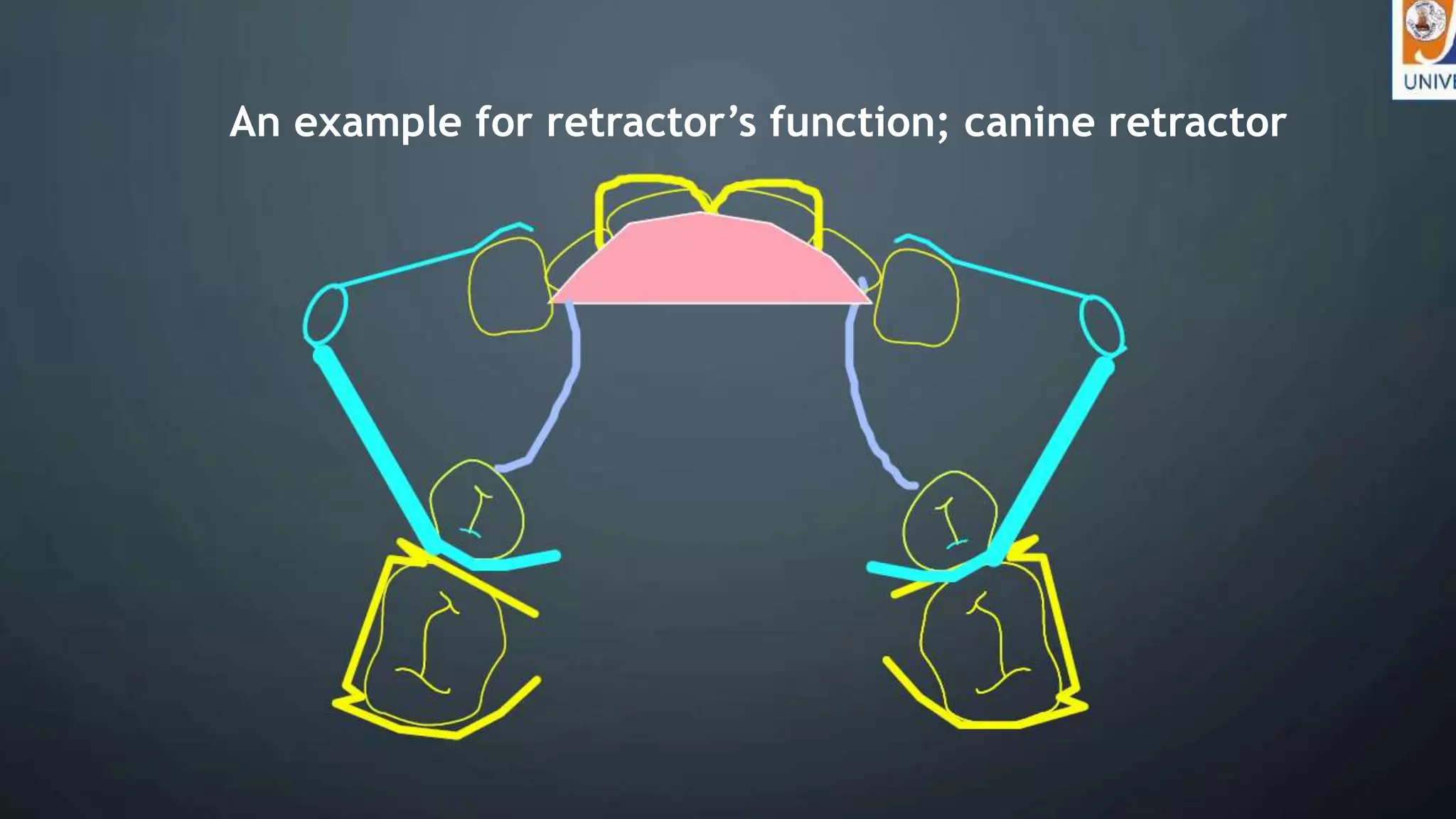 Labial bow Functions , Constructions , Types & Indications. | PPTX