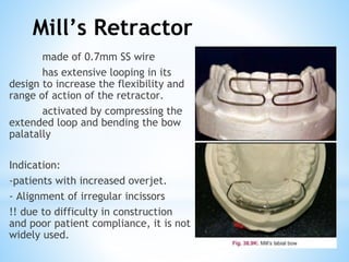 Mill’s Retractor
made of 0.7mm SS wire
has extensive looping in its
design to increase the flexibility and
range of action of the retractor.
activated by compressing the
extended loop and bending the bow
palatally
Indication:
-patients with increased overjet.
- Alignment of irregular incissors
!! due to difficulty in construction
and poor patient compliance, it is not
widely used.
 