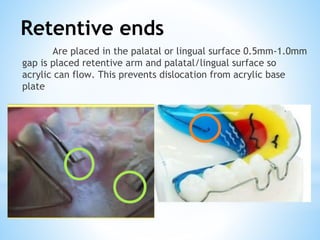 Retentive ends
Are placed in the palatal or lingual surface 0.5mm-1.0mm
gap is placed retentive arm and palatal/lingual surface so
acrylic can flow. This prevents dislocation from acrylic base
plate
 