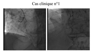 Cas clinique n°1
 