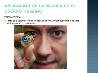 Aplicación de la biónica en el cuerpo humanoVISIÓN ARTIFICIAL:Trata de traducir el mundo visual a un sistema informático que sea capaz de interactuar con el medio