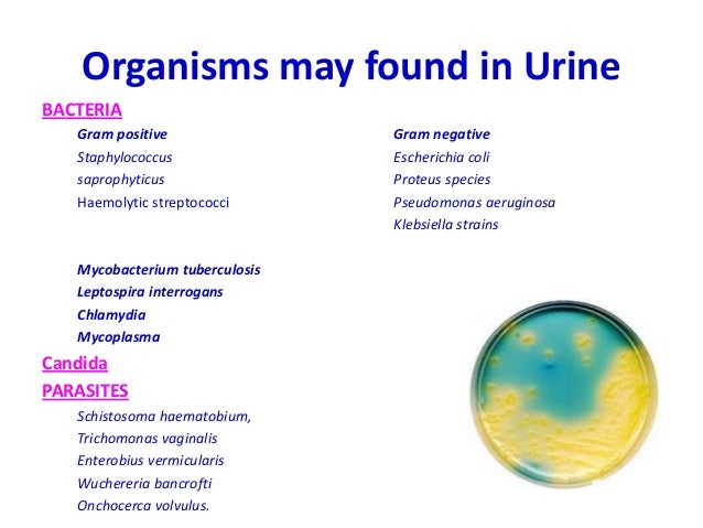 what causes bacteria in urine