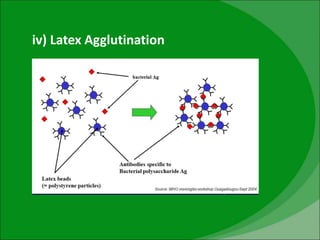iv) Latex Agglutination
 