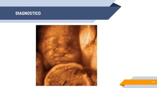 DIAGNOSTICO
11
 