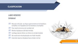 CLASIFICACION
LABIO HENDIDO
Unilateral
14
▰ Musculo orbicular: se dirige superiormente en la hendidura
completa o es hipoplásico en la hendidura incompleta
▰ Piso nasal comunica con cavidad oral
▰ Maxilar hipoplasico del lado hendido
▰ Cartílago lateral inferior es inferior en el lado hendido
▰ Ala nasal está retrodisplazado en el lado hendido
▰ Columela nasal se desplaza hacia el lado normal
 