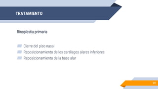 TRATAMIENTO
Rinoplastia primaria
31
▰ Cierre del piso nasal
▰ Reposicionamiento de los cartílagos alares inferiores
▰ Reposicionamiento de la base alar
 