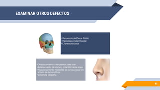 EXAMINAR OTROS DEFECTOS
41
•Secuencia de Pierre Robin
•Hipoplasia malar/maxilar
•Craneosinostosis
•Desplazamiento inferolateral base alar
•Aplanamiento de domo y rotación hacia abajo
•Posicionamiento horizontal de la fosa nasal en
el lado de la hendidura
•Columela pequeña
 