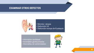 EXAMINAR OTROS DEFECTOS
42
• Microtia / atresia
• Disfunción VII
• Disfunción trompa de Eustaquio
• Anomalías cardiacas
• Anomalías genitourinarias
• Anomalías de extremidades
 