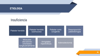 ETIOLOGIA
Insuficiencia
46
Paladar hendido
Paladar hendido
submucoso
Paladar corto
congénito
Desproporción
palatofaringea
Músculos
elevadores
orientados
longitudinalmente
Amígdalas
hipertróficas
Adenoidectomia
 