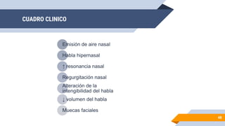 CUADRO CLINICO
Emisión de aire nasal
Habla hipernasal
↑ resonancia nasal
Regurgitación nasal
Alteración de la
intengibilidad del habla
↓ volumen del habla
Muecas faciales
48
 
