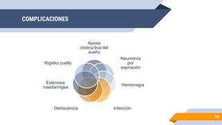 COMPLICACIONES
Apnea
obstructiva del
sueño
Neumonía
por
aspiración
Hemorragia
Infección
Dehiscencia
Estenosis
nasofaríngea
Rigidez cuello
56
 