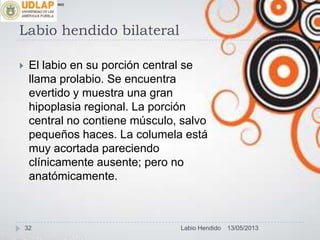 Labio hendido bilateral
 El labio en su porción central se
llama prolabio. Se encuentra
evertido y muestra una gran
hipoplasia regional. La porción
central no contiene músculo, salvo
pequeños haces. La columela está
muy acortada pareciendo
clínicamente ausente; pero no
anatómicamente.
∞π
13/05/201332 Labio Hendido
 