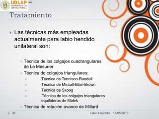 Tratamiento
 Las técnicas más empleadas
actualmente para labio hendido
unilateral son:
 Técnica de los colgajos cuadrangulares
de Le Mesurier
 Técnica de colgajos triangulares:
 Técnica de Tennison-Randall
 Técnica de Mirault-Blair-Brown
 Técnica de Skoog
 Técnica de los colgajos triangulares
equiláteros de Malek
 Técnica de rotación avance de Millard
∞π
13/05/201337 Labio Hendido
 