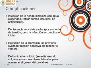 Complicaciones
 Infección de la herida (limpieza con agua
oxigenada, retirar puntos incluidos, no
antibióticos).
 Dehiscencia o cicatriz ancha (por aumento
de tensión, pero la infección la complica o
inicia).
 Retrusión de la premaxila (se previene
evitando tracción excesiva, no resecar el
vómer).
 Deformidad en silbido (se evita usando
colgajos mocomusculares laterales para
aumentar el grosor del prolabio).
∞π
13/05/201345 Labio Hendido
 