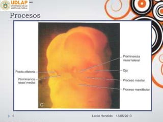 Procesos
∞π
13/05/20136 Labio Hendido
 