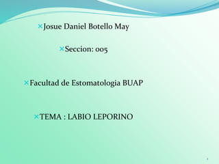 Josue Daniel Botello May
Seccion: 005
Facultad de Estomatologia BUAP
TEMA : LABIO LEPORINO
1
 
