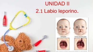 UNIDAD II
2.1 Labio leporino.
 