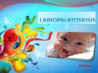 Labiopalatoskisis