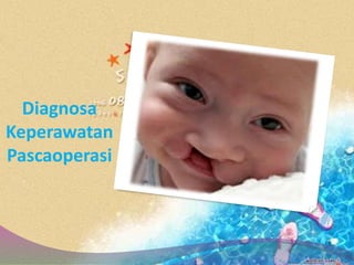 Diagnosa
Keperawatan
Pascaoperasi
 