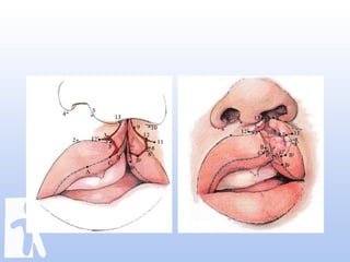Labioplasty jumat ilmiah
