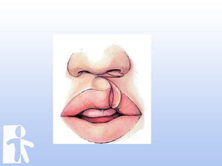 Labioplasty jumat ilmiah