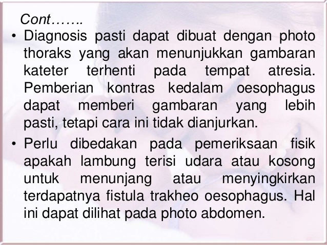 Cacat bawaan