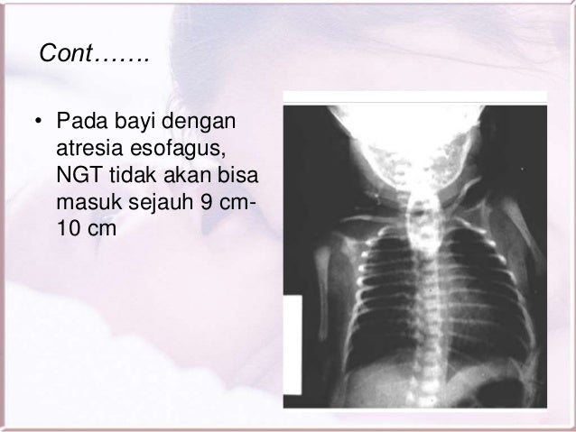 Cacat bawaan