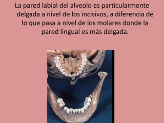 La pared labial del alveolo es particularmente
delgada a nivel de los incisivos, a diferencia de
lo que pasa a nivel de los molares donde la
pared lingual es más delgada.
 