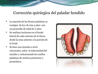 Corrección quirúrgica del paladar hendido
• La mayoría de las fisuras palatinas se
corrigen de los 18 a los 3 años con
un promedio de edad de 2 años
• Se realizan incisiones en el borde
lateral de cada extremo de la fisura
desde la zona anterior a la porción de
la úvula
• Se hace una incisión a nivel
retromolar, sobre la tuberosidad del
maxilar y contorneando los cuellos
palatinos de molares primarios o
premolares.
 
