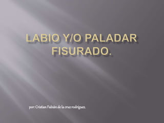 por: Cristian Fabián de la cruz rodríguez. 
 