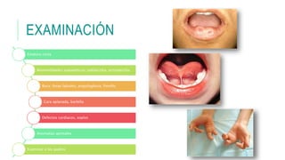EXAMINACIÓN
Estatura corta
Anormalidades esqueléticas: polidactilia, ectrodactilia
Boca: fosas labiales, anquiloglosia, frenillo
Cara aplanada, barbilla
Defectos cardiacos, soplos
Anomalías genitales
Examinar a los padres
 