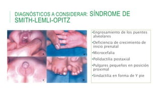 DIAGNÓSTICOS A CONSIDERAR: SÍNDROME DE
SMITH-LEMLI-OPITZ
•Engrosamiento de los puentes
alveolares
•Deficiencia de crecimiento de
inicio prenatal
•Microcefalia
•Polidactilia postaxial
•Pulgares pequeños en posición
proximal
•Sindactilia en forma de Y pie
 