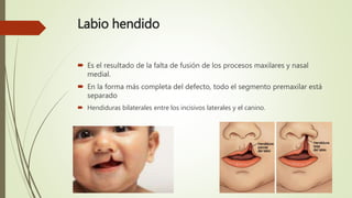 Labio hendido
 Es el resultado de la falta de fusión de los procesos maxilares y nasal
medial.
 En la forma más completa del defecto, todo el segmento premaxilar está
separado
 Hendiduras bilaterales entre los incisivos laterales y el canino.
 