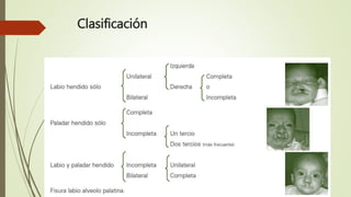 Clasificación
 