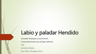 Labio y paladar Hendido
González Rodríguez Josué Antonio
Universidad Autónoma de Baja California
466
Genética Medica
Dra. Falcon Noriega Leticia
 