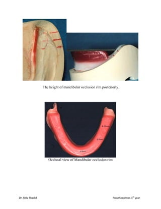 Occlusal Rim Inclinator 123 | PDF