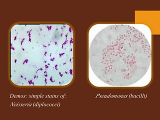 simple stain gram positive gram negative