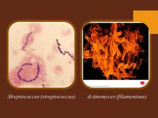 simple stain gram positive gram negative