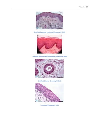 P a g e | 19
Stratified Squamous Keratinized (Scarbrough 2013)
Stratified Squamous Non Keratinized (Frankhauser 2008)
Stratified Cuboidal (Scarbrough 2013)
Transitional (Scarbrough 2013)
 