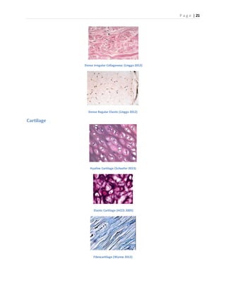 P a g e | 21
Dense Irregular Collagenous (Linggo 2012)
Dense Regular Elastic (Linggo 2012)
Cartilage
Hyaline Cartilage (Schaefer 2013)
Elastic Cartilage (HCCS 2005)
Fibrocartilage (Wynne 2012)
 
