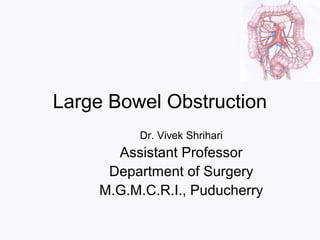Large Bowel Obstruction
Dr. Vivek Shrihari
Assistant Professor
Department of Surgery
M.G.M.C.R.I., Puducherry
 