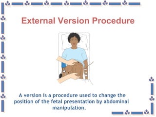External Version Procedure
A version is a procedure used to change the
position of the fetal presentation by abdominal
manipulation.
 