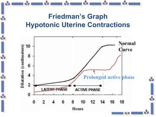 Friedman’s Graph
Hypotonic Uterine Contractions
Prolonged active phase
Normal
Curve
 